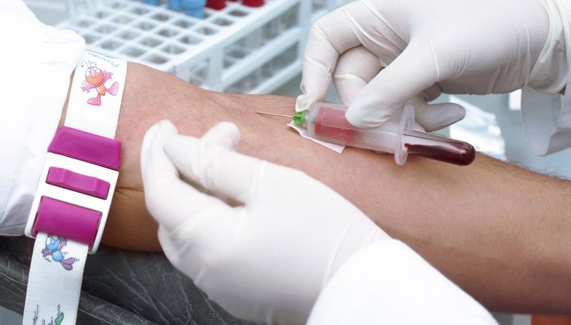 Imagen de Biometría Hemática Completa