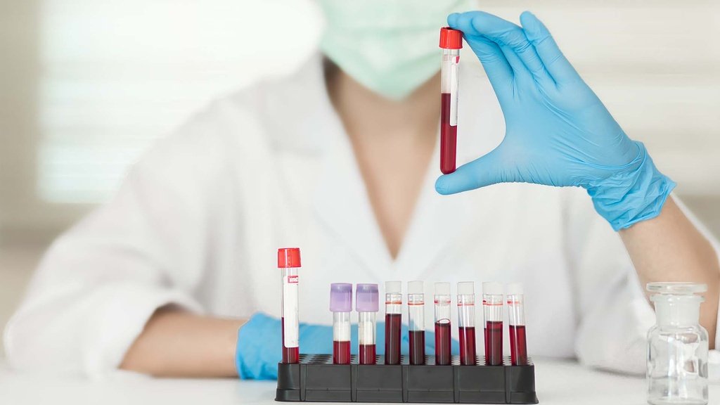 Imagen de Química Sanguínea de 6 Elementos