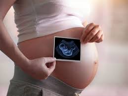 Imagen de Perfil Prenatal